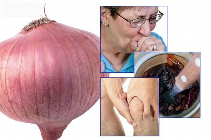 La cebolla reduce los síntomas de fatiga, ansiedad y depresión La cebolla reduce los síntomas de fatiga, ansiedad y depresión